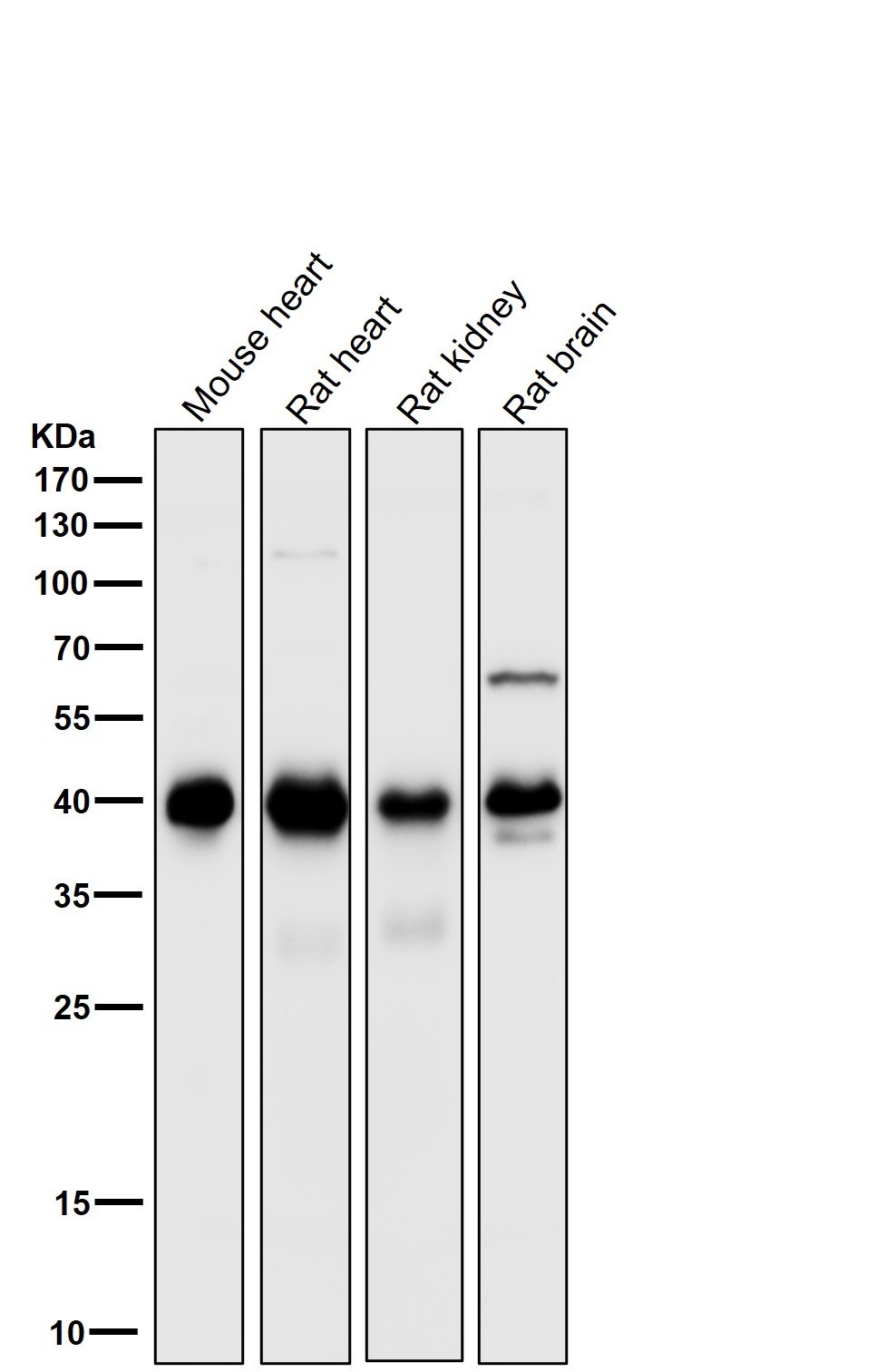 PDHA1 Ab