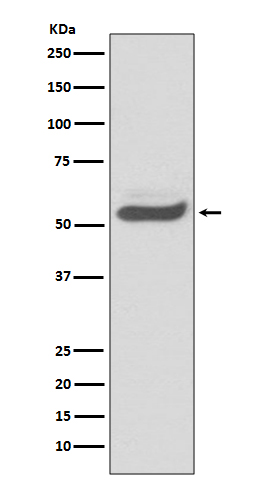 Antithrombin 3 Ab