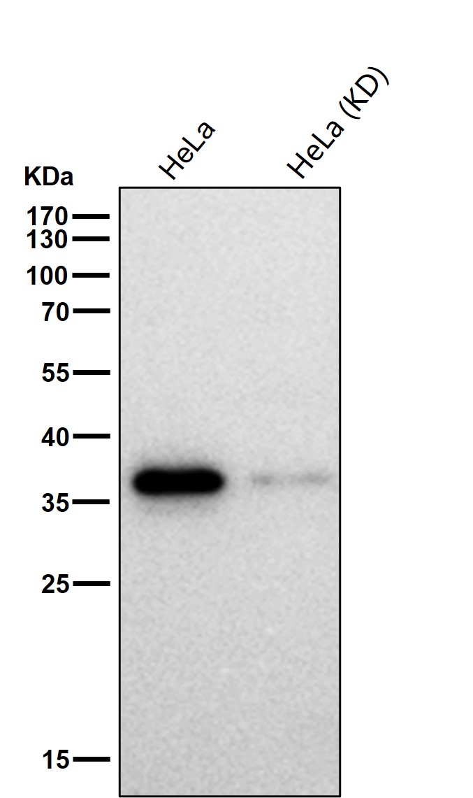 ERCC1 Ab