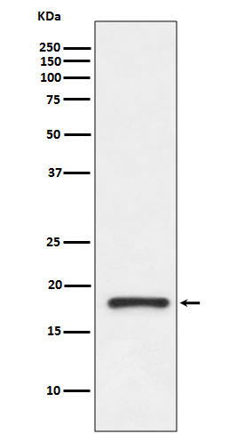 Transthyretin Ab