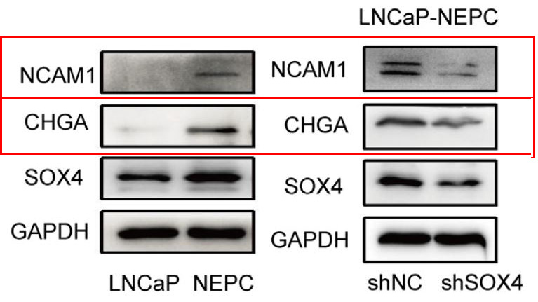 NCAM 1 Ab