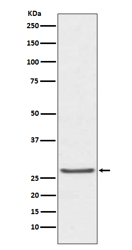 TIMP1 Ab