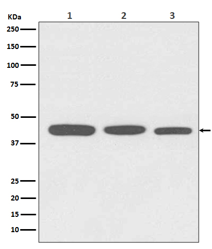 alpha Skeletal muscle actin Ab