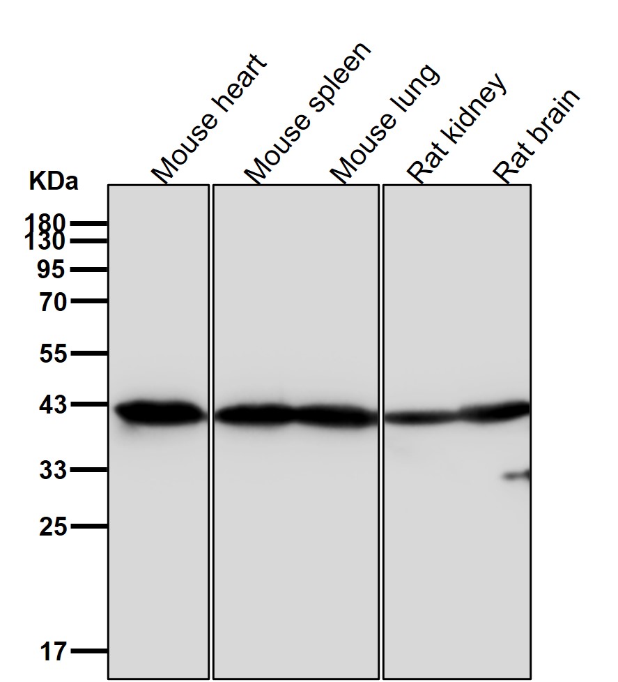 alpha Skeletal muscle actin Ab