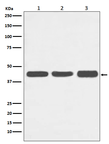 alpha Skeletal muscle actin Ab