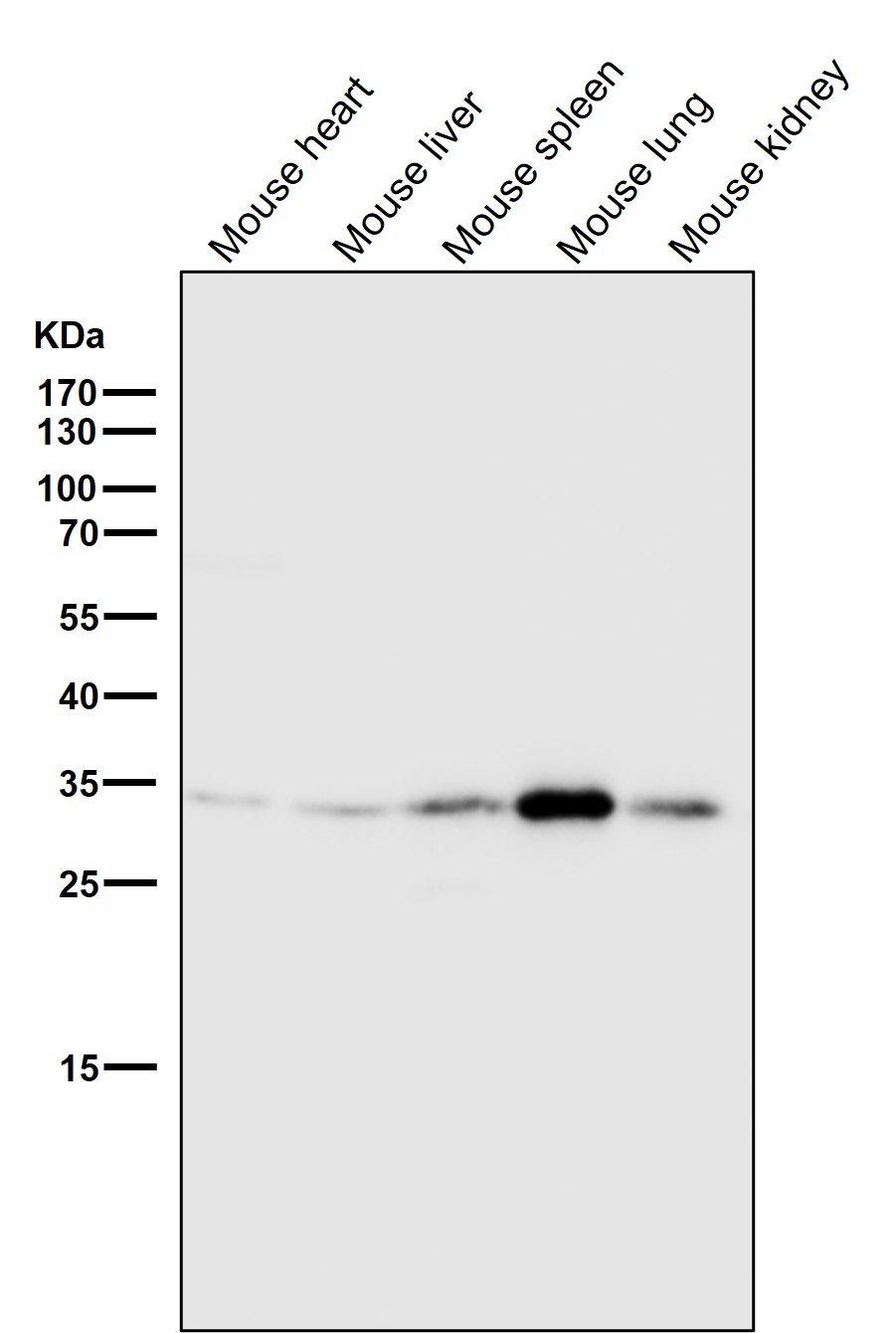 Annexin V Ab