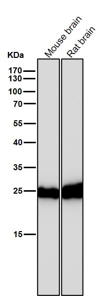 PGP9.5 Ab