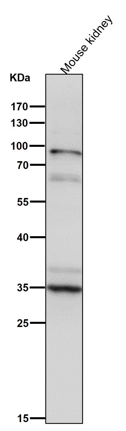 XBP1 Ab