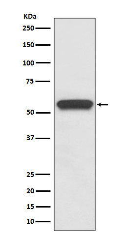 Aromatase Ab