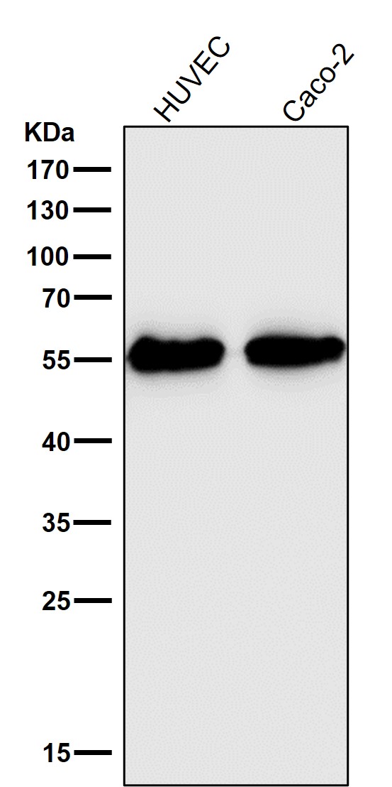 Aromatase Ab