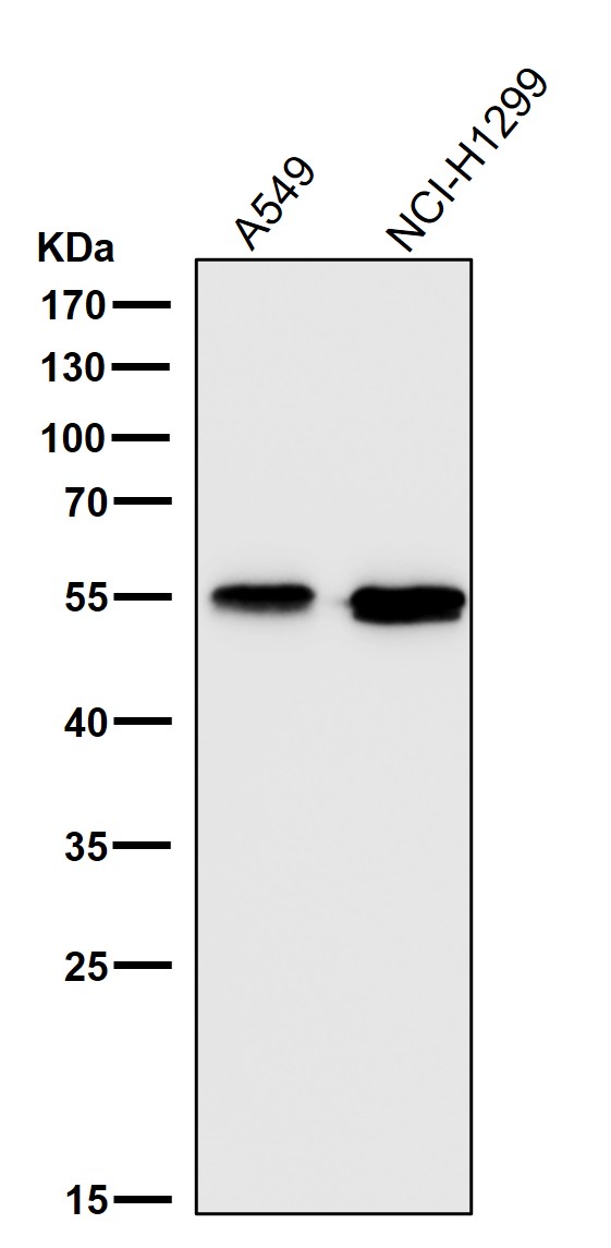 Aromatase Ab