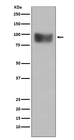 IFN alpha/beta receptor 1 Ab