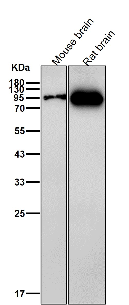 IFN alpha/beta receptor 1 Ab