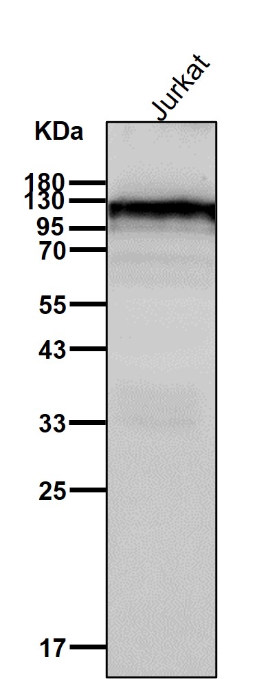 IFN alpha/beta receptor 1 Ab