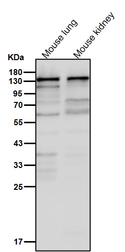 SMC3 Ab