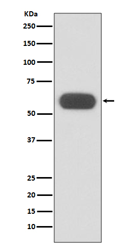 Lysosomal acid GCase Ab