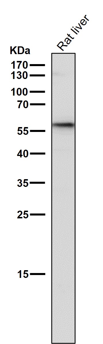 Lysosomal acid GCase Ab