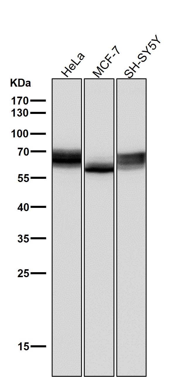 Lysosomal acid GCase Ab