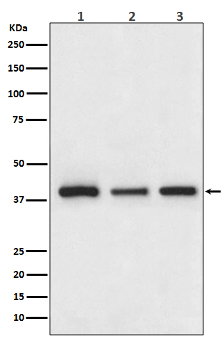 Cathepsin L/V/K/H Ab