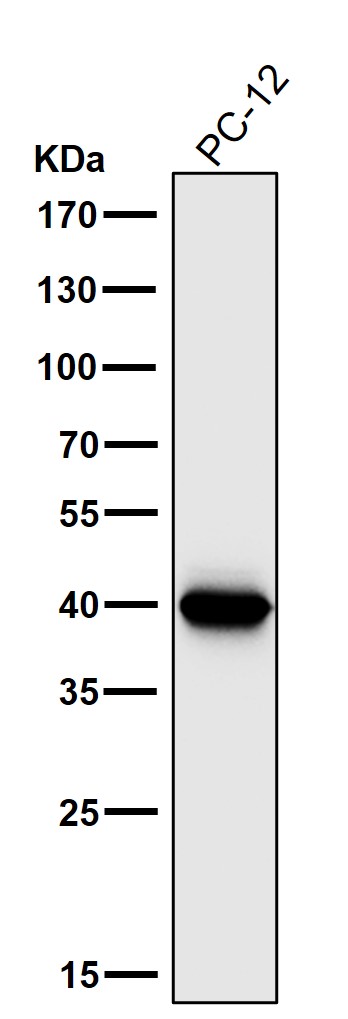 Cathepsin L/V/K/H Ab