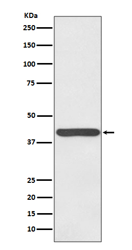 Haptoglobin Ab