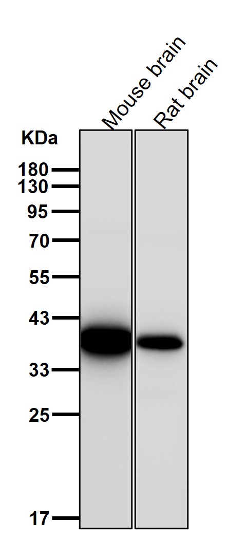 Haptoglobin Ab