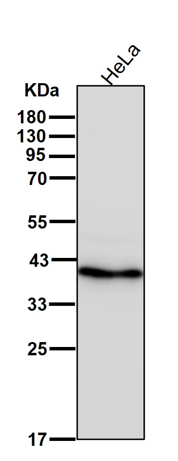 Haptoglobin Ab