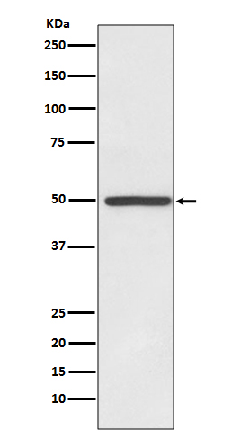 Dopamine transporter Ab