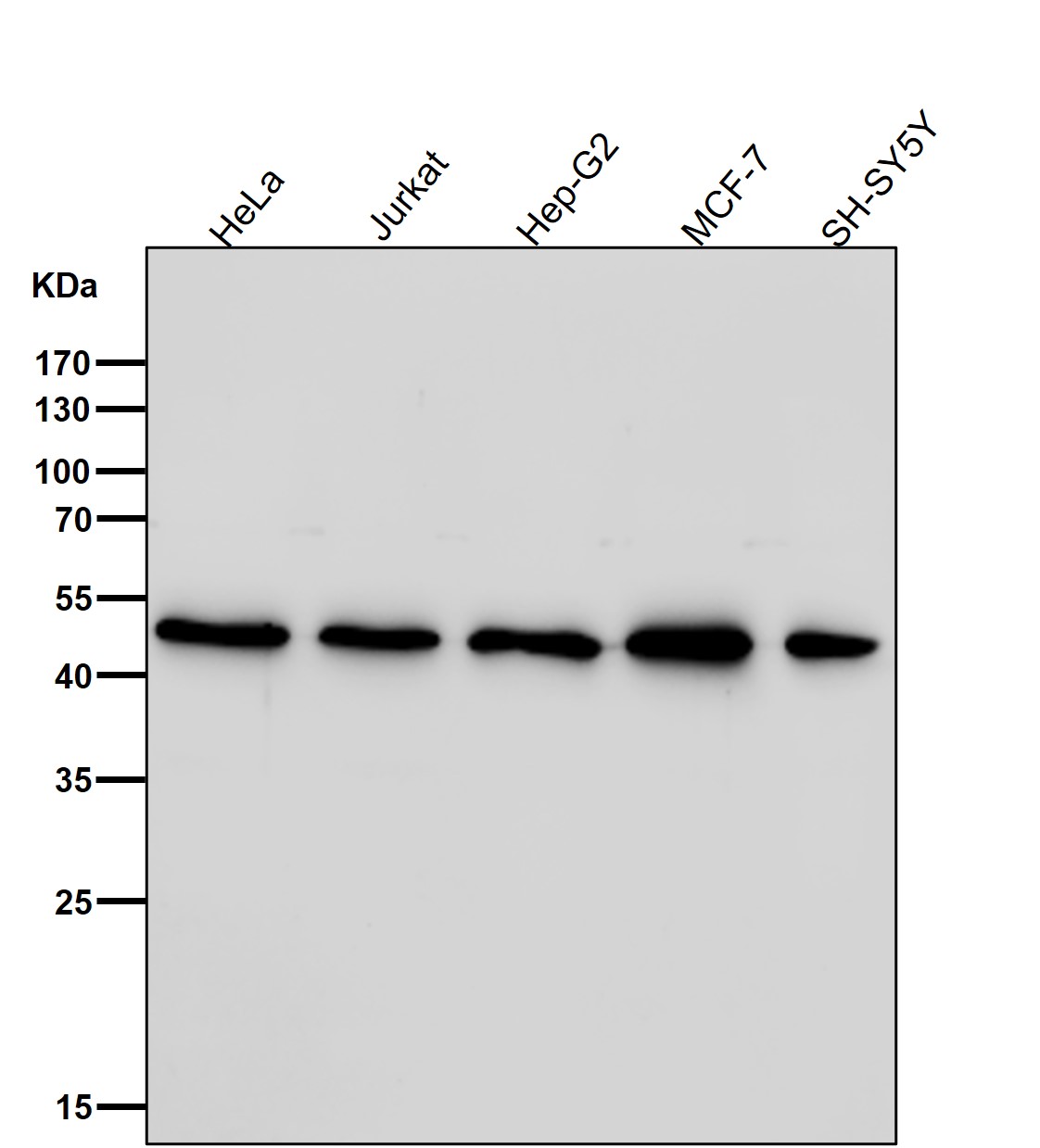 Dopamine transporter Ab