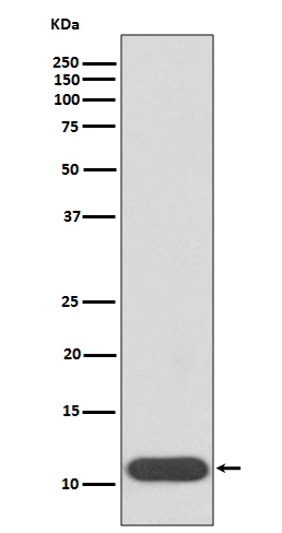 Hemoglobin gamma 1/2 Ab