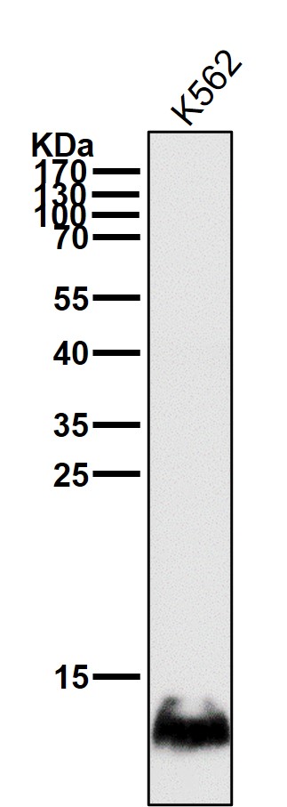 Hemoglobin gamma 1/2 Ab