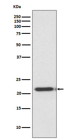 TIMP2 Ab