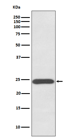 Growth hormone Ab