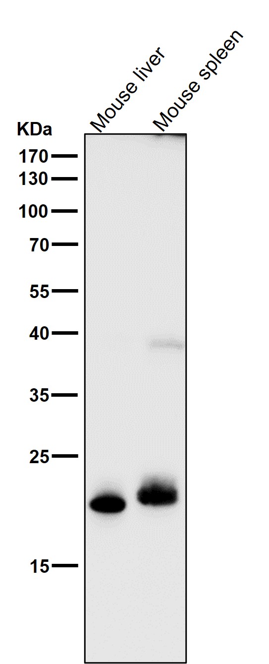 FGF21 Ab