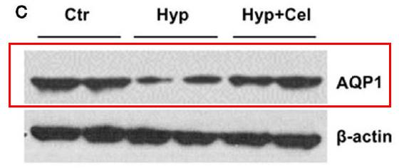 Aquaporin 1 Ab