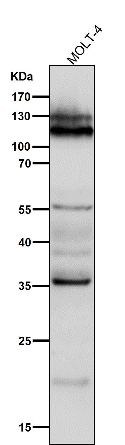 NFATc2 Ab