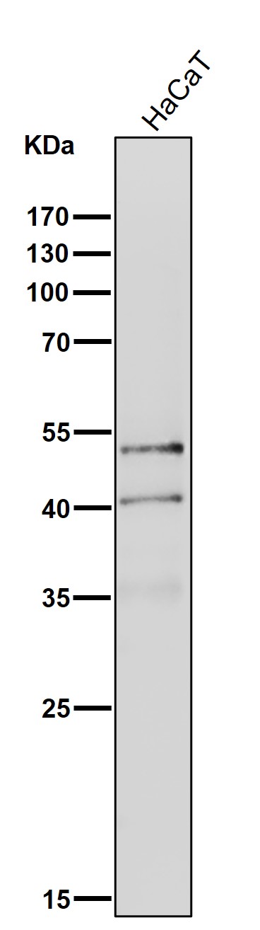 NeuroD Ab