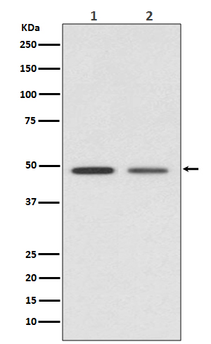 Vitamin D3 receptor Ab