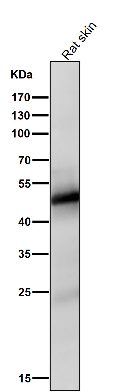 Vitamin D3 receptor Ab