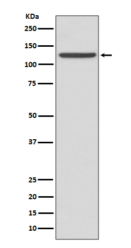 Integrin alpha 2b Ab