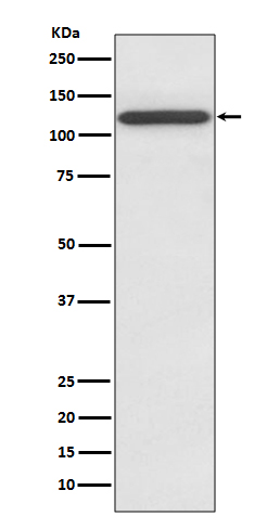 GluN1 Ab