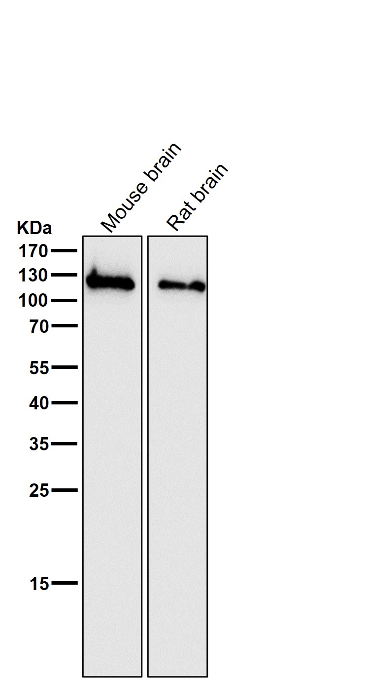 GluN1 Ab