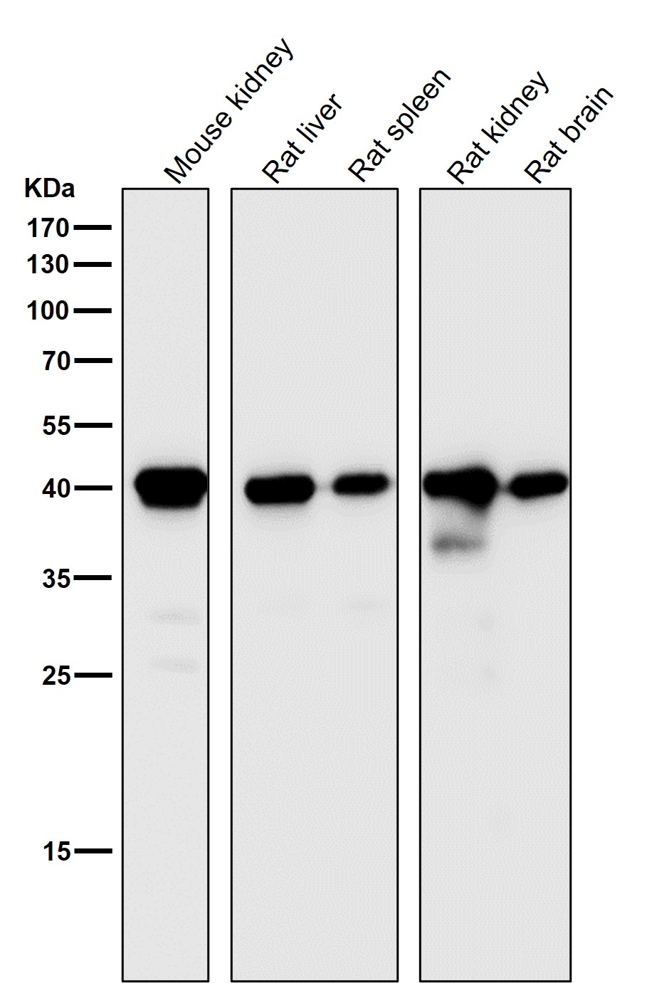 CD40L Ab