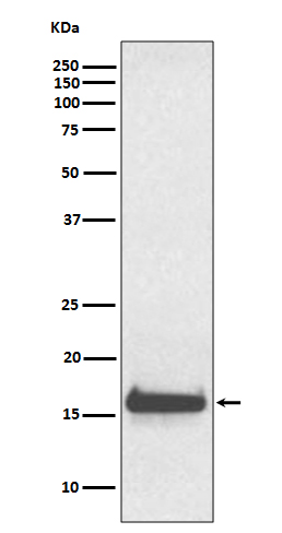 Transthyretin Ab