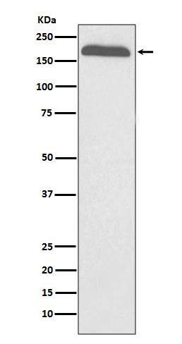 alpha 2 Macroglobulin Ab