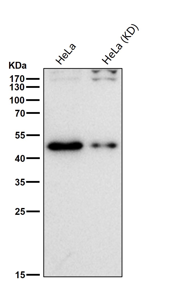 TDP43 Ab