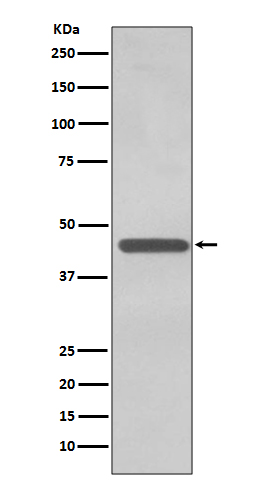 TDP43 Ab