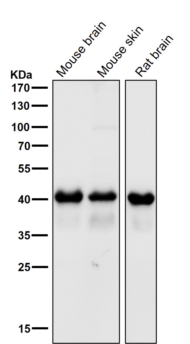 TDP43 Ab