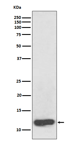 Serum amyloid A Ab