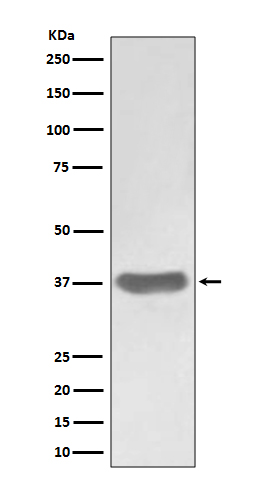 FRP 1 Ab